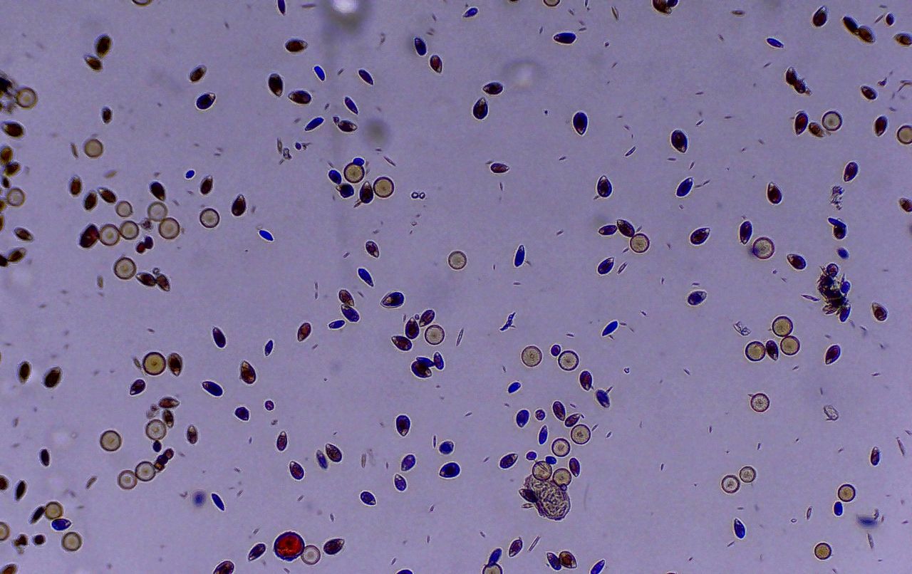 Ostreopsis ovata, la sentinella del Mediterraneo che cambia